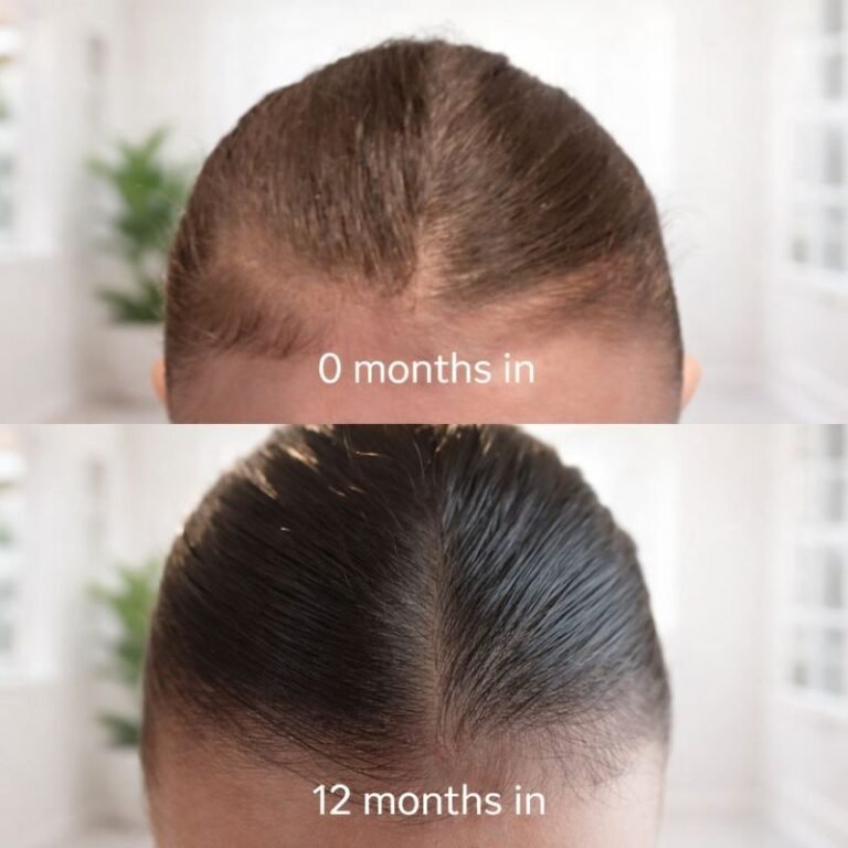 My Hair Growth Journey & What Actually Worked