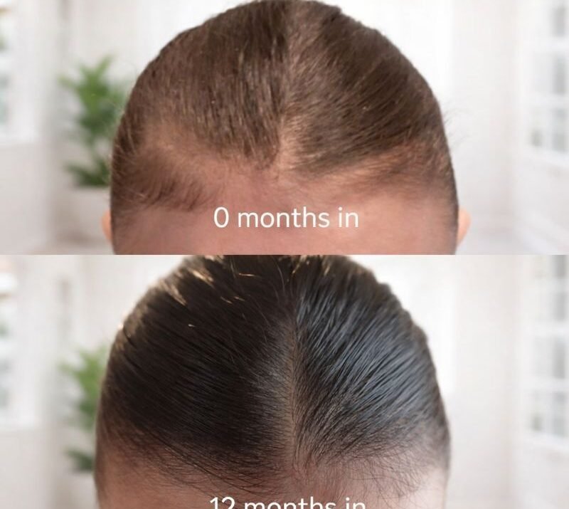 My Hair Growth Journey & What Actually Worked